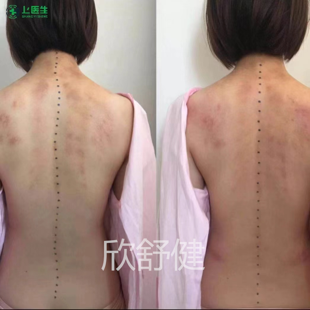 青少年整脊1