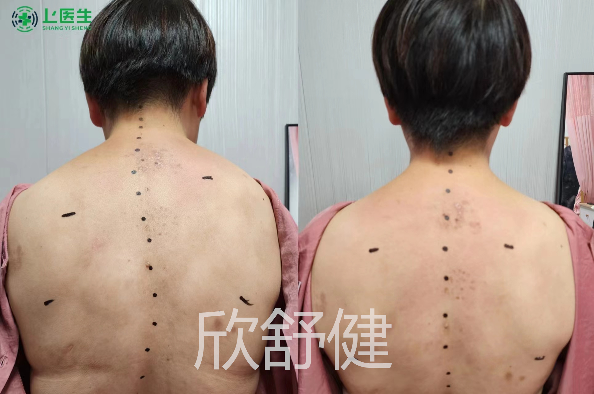 徒手整骨2