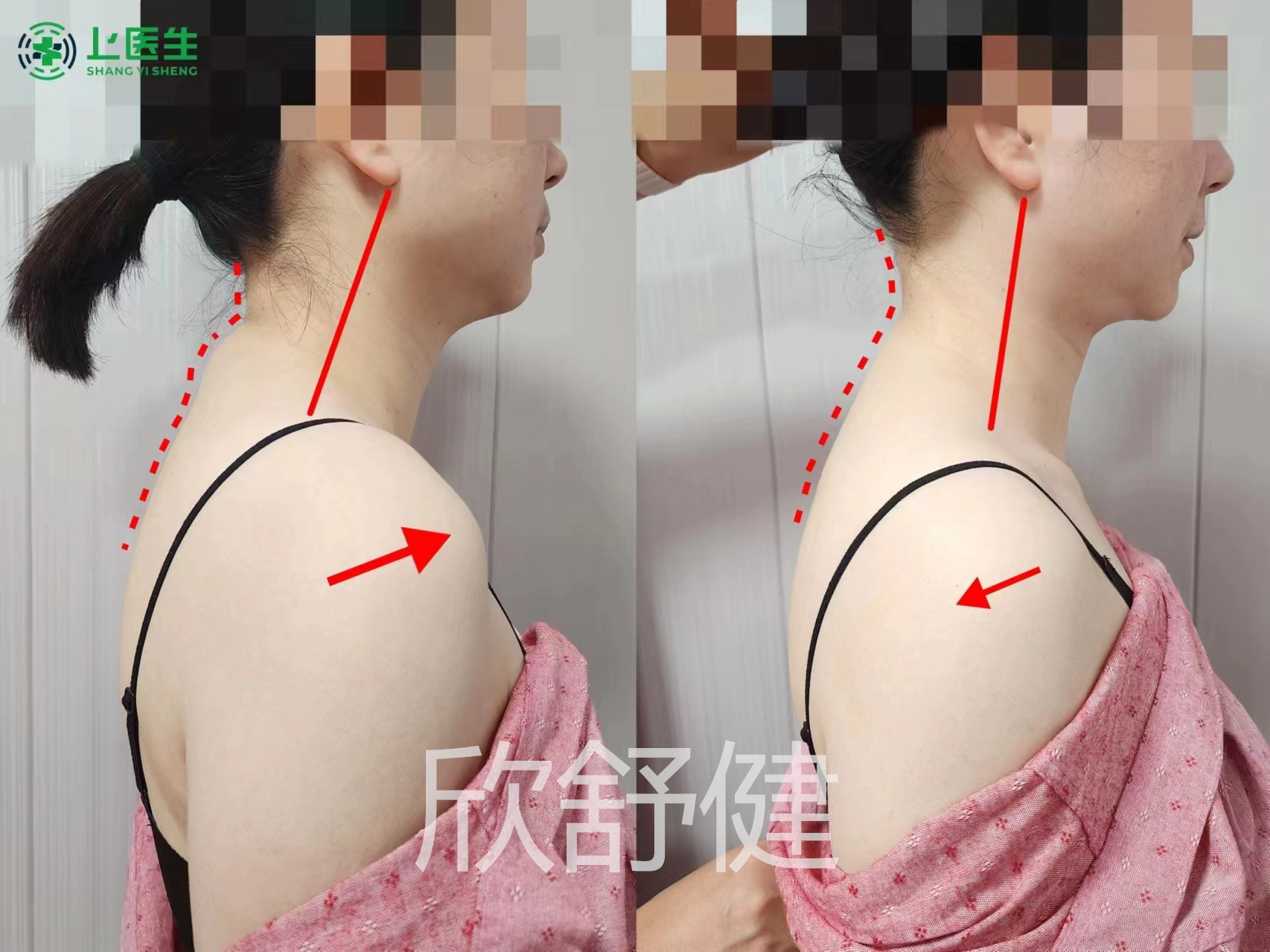 徒手整骨