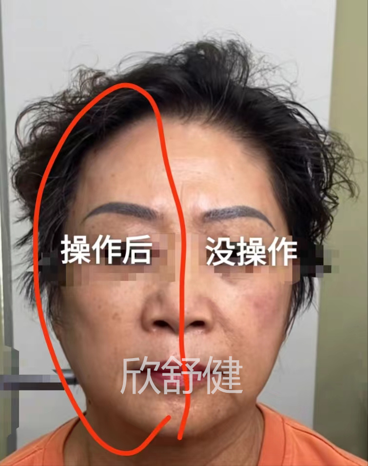 徒手整型3