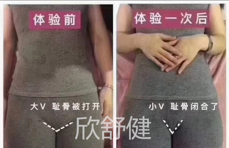 骨盆修复