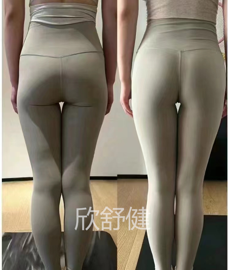 骨盆修复案例2